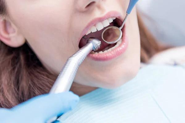 Expert Dentist Dallas Providing Gentle Dental Treatments
